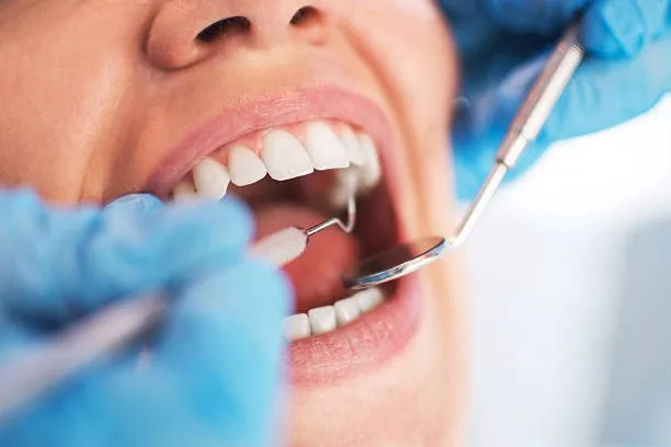 Dentist examining a patient's teeth